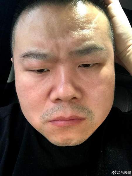 第2张图片